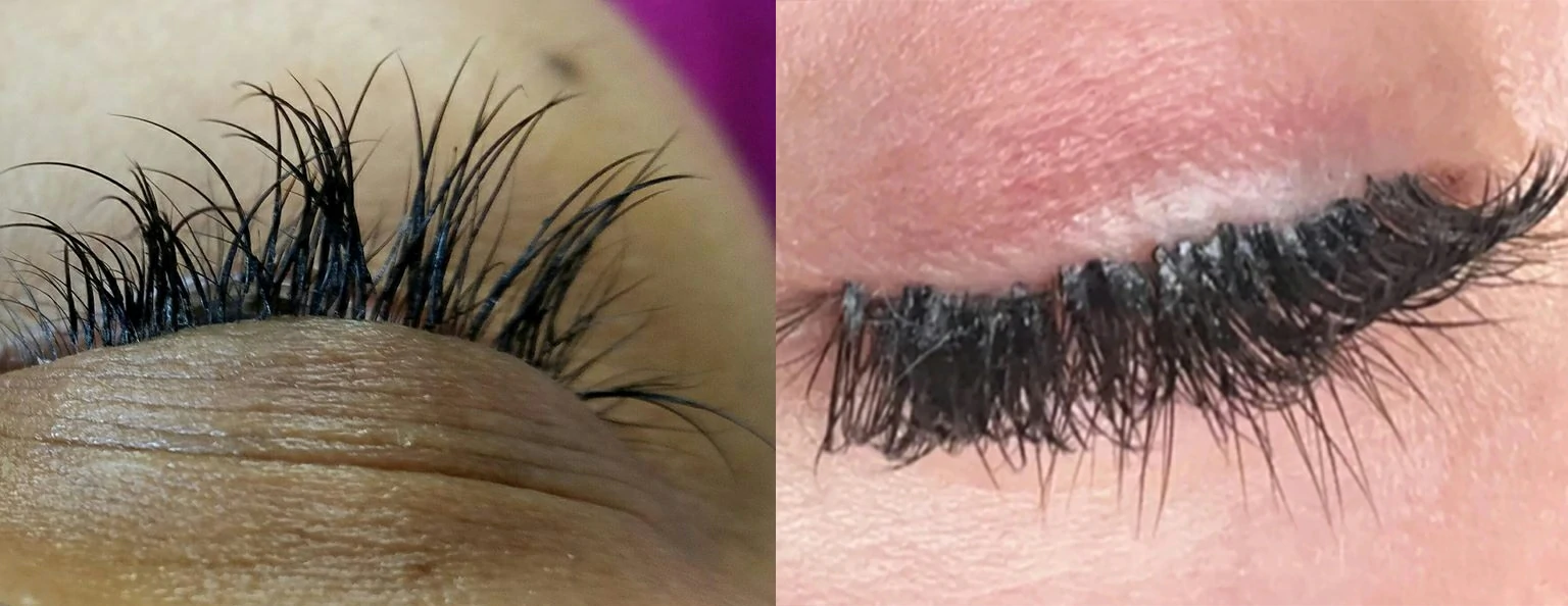 badlash